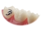 Preview: VIPER™, Lepicí bukální trubička Mini (zub 17, 37) standard .018" (zkroucení 0°, offset 0°)